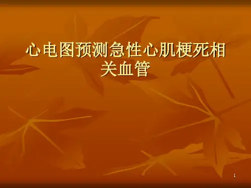 心电图导联定位PPT课件