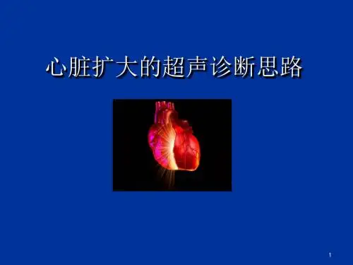 心脏扩大的超声诊断思路ppt课件