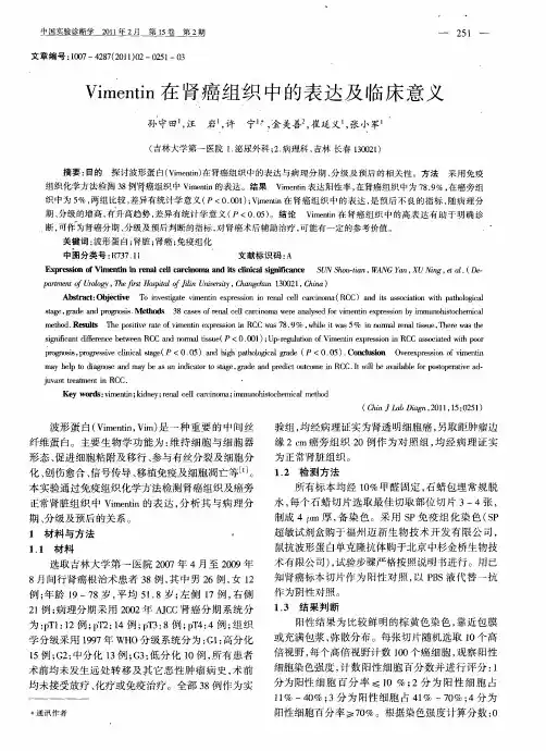 Vimentin在肾癌组织中的表达及临床意义