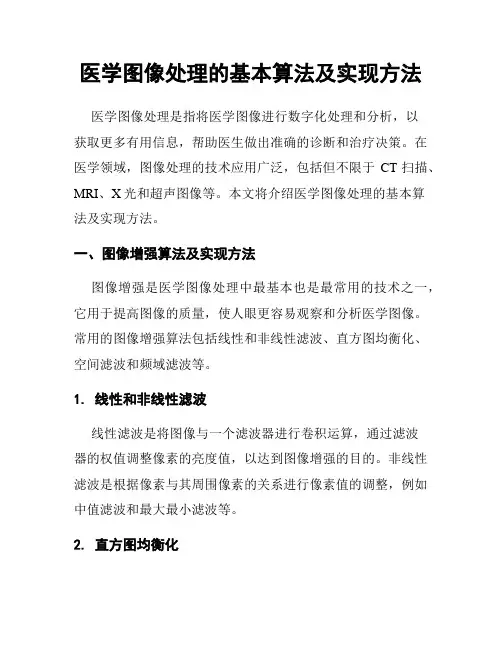 医学图像处理的基本算法及实现方法