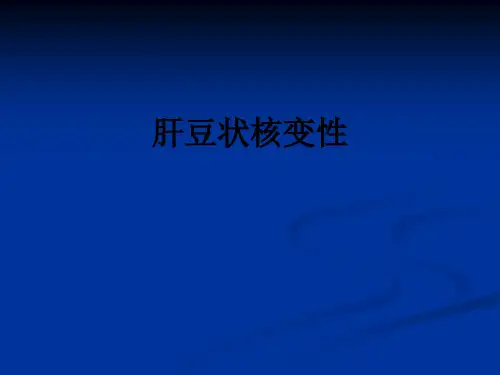 肝豆状核变性ppt课件