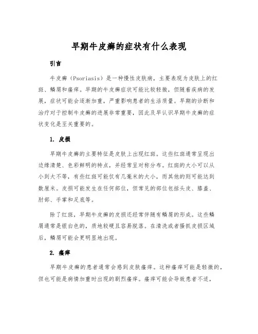 早期牛皮癣的症状有什么表现[1]