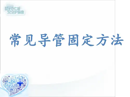 常见导管固定方法