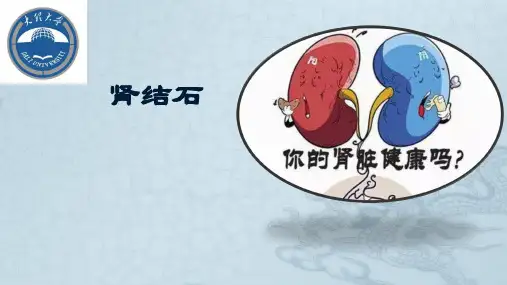 肾结石PPT课件