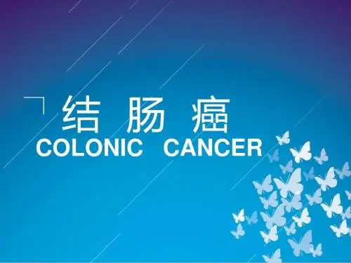 结肠癌  ppt课件