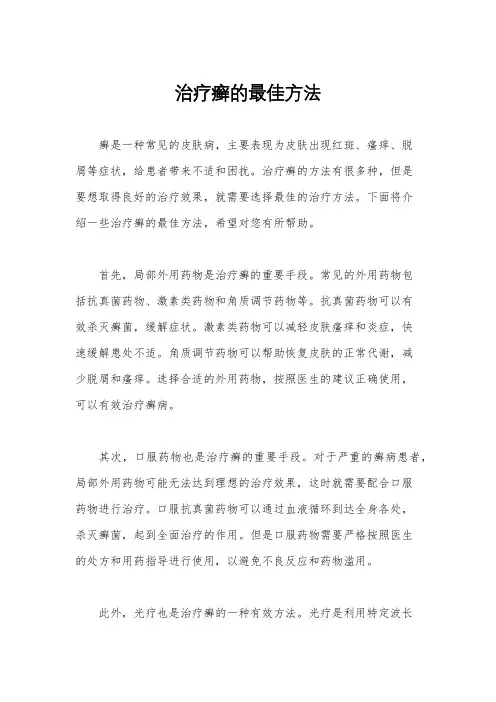 治疗癣的最佳方法