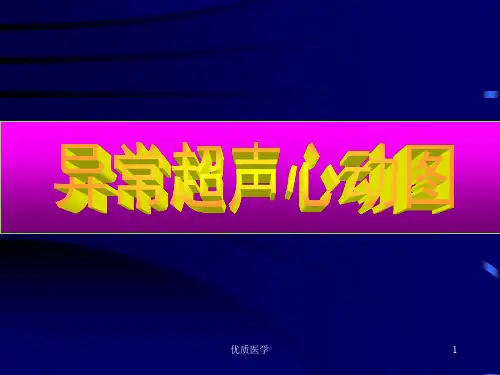 心脏彩超诊断(清晰详实)