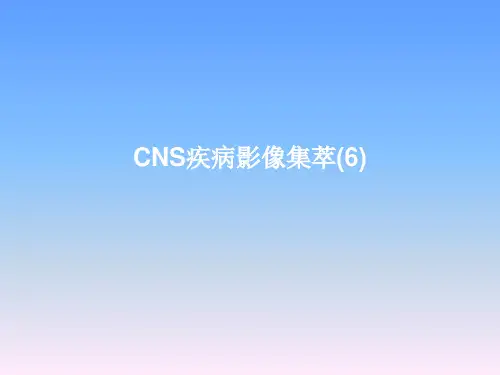 CNS疾病MRI诊断ppt课件