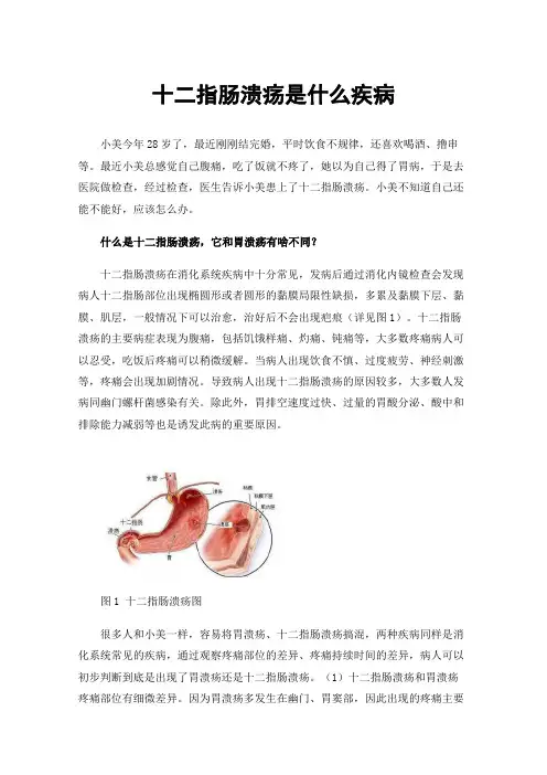 十二指肠溃疡是什么疾病