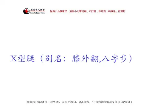 X型腿(别名：膝外翻,八字步)