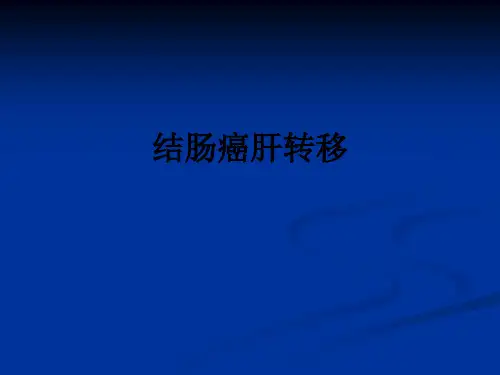 结肠癌肝转移ppt课件