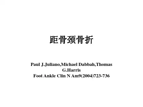 距骨解剖