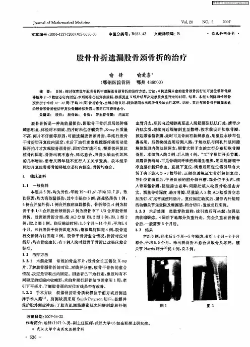 股骨骨折遗漏股骨颈骨折的治疗