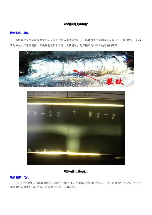 射线检测典型缺陷
