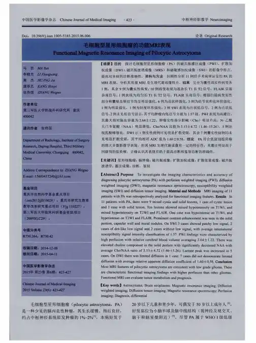 毛细胞型星形细胞瘤的功能MRI表现