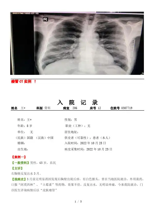 重庆开阳医院病历证明,CT诊断证明实例-副本