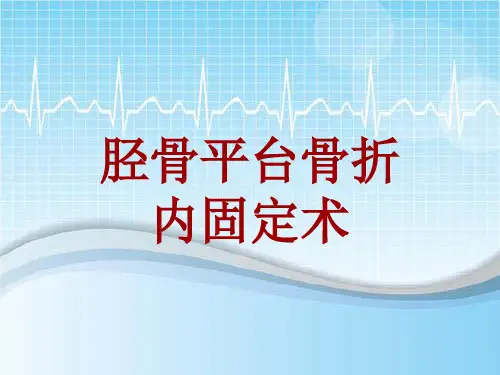 外科手术教学资料：胫骨平台骨折内固定术讲解模板