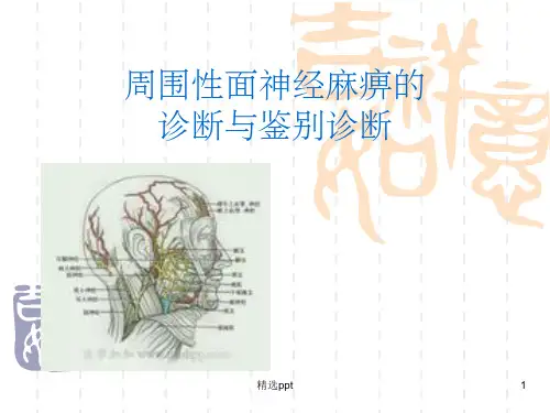 面神经麻痹的诊断与鉴别诊断ppt课件