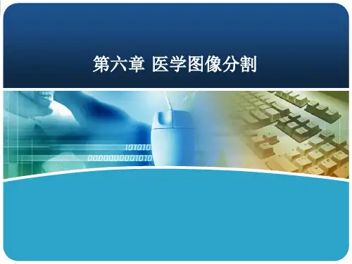 医学图像处理与分析第六章 医学图像分割PPT课件