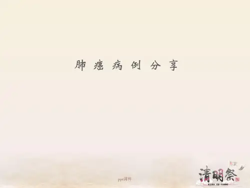 肺癌病例分享  ppt课件