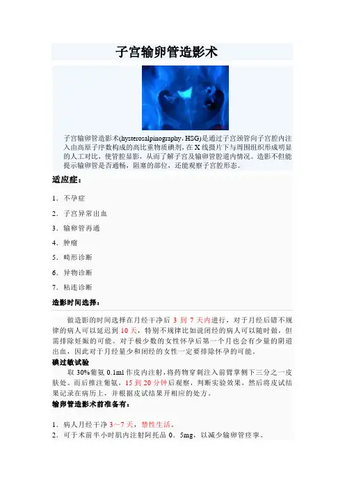 子宫输卵管造影术