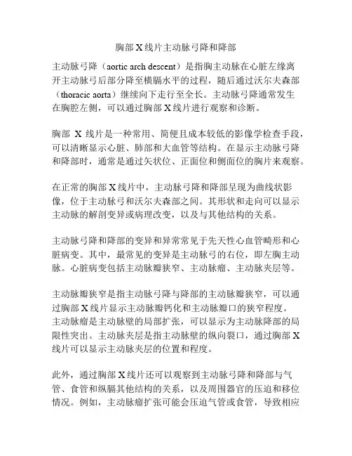 胸部X线片主动脉弓降和降部