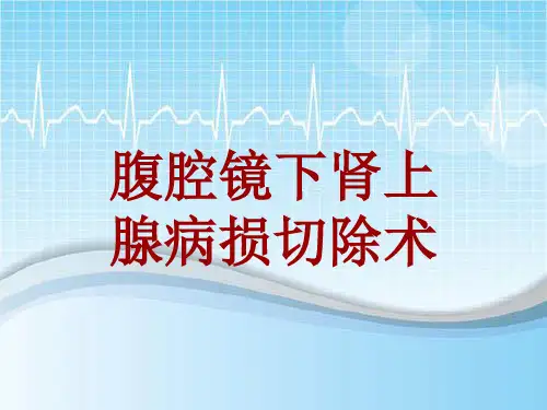 手术讲解模板：腹腔镜下肾上腺病损切除术