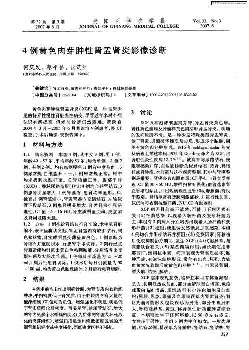 4例黄色肉芽肿性肾盂肾炎影像诊断