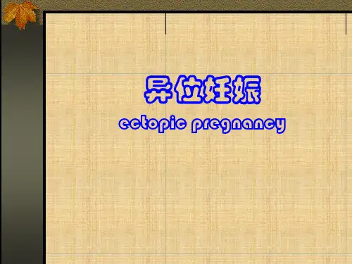 异位妊娠-精品医学课件