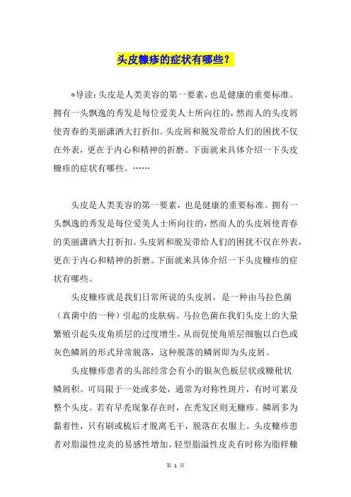 头皮糠疹的症状有哪些？