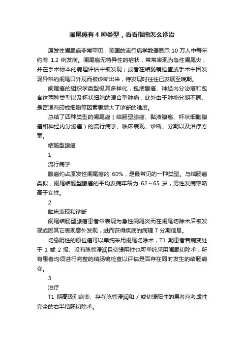 阑尾癌有4种类型，看看指南怎么诊治