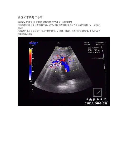 胎盘异常的超声诊断