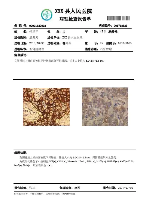 病理报告单模板(可自行修改、编辑)
