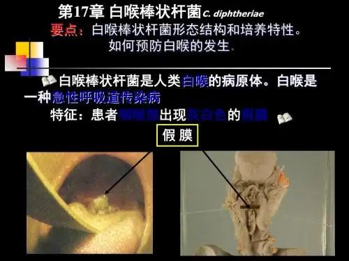 医学微生物学课件-棒状杆菌 共20页