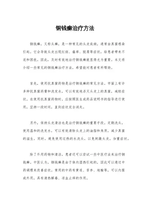 铜钱癣治疗方法