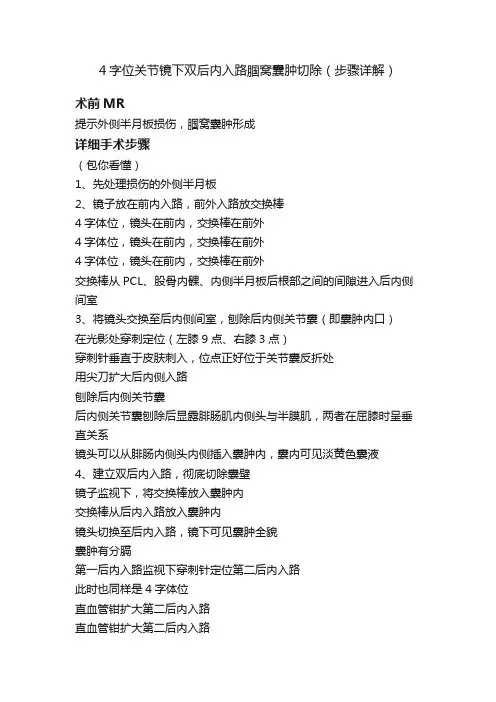 4字位关节镜下双后内入路腘窝囊肿切除（步骤详解）