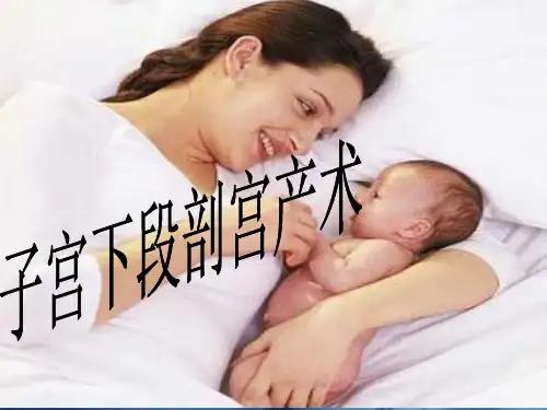 剖宫产手术分析
