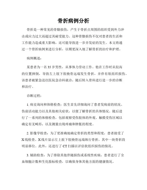 骨折病例分析
