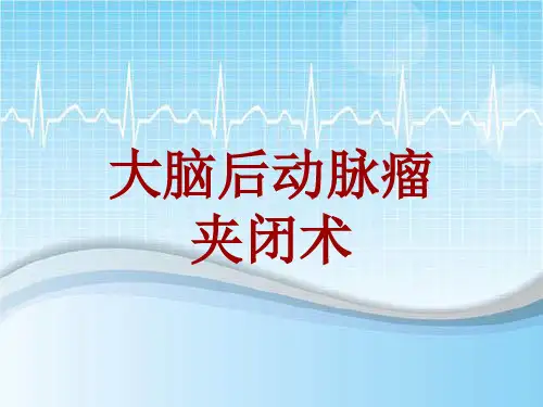 手术讲解模板：大脑后动脉瘤夹闭术