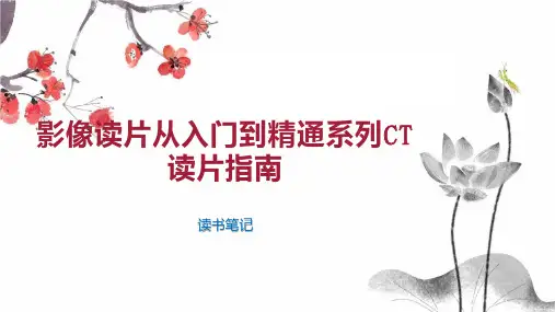 影像读片从入门到精通系列CT读片指南