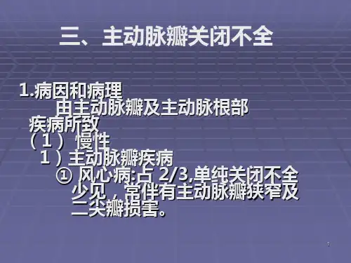 主动脉瓣关闭不全PPT课件