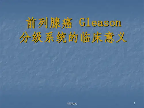 前列腺癌Gleason分级的临床意义