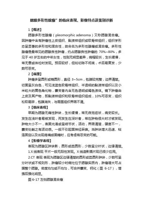 腮腺多形性腺瘤”的临床表现、影像特点及鉴别诊断