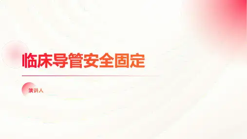 临床导管安全固定
