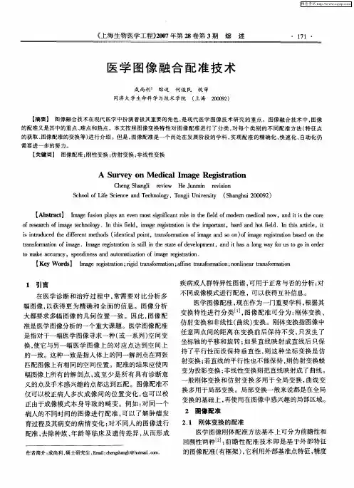 医学图像融合配准技术