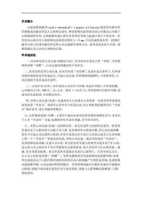 射频消融术