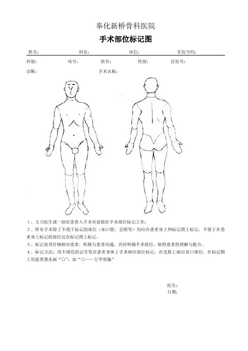 手术部位标记图