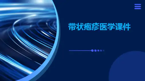 带状疱疹医学课件
