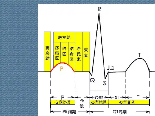 心房心室肥大心电图表现和诊断课件