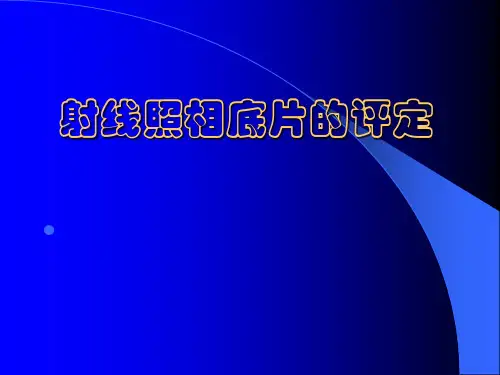 无损检测射线照相底片的评定